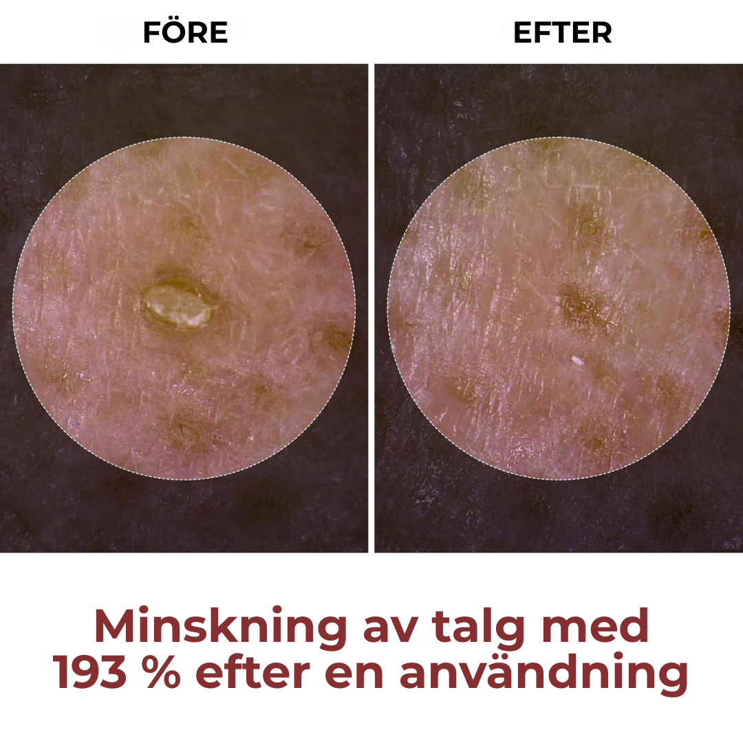 Nordvik Melaxin – För en klarare, slät hud utan irritation